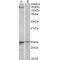 RNA Binding Motif Protein 20 (RBM20) Antibody