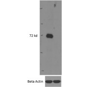 Western blot analysis of Mouse Bone Marrow (wildtype first lane, KO second lane) lysates (35 µg protein in RIPA buffer) using IRAK3 antibody (0.5 µg/ml).