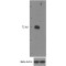 Interleukin-1 Receptor Associated Kinase 3 (IRAK3) Antibody