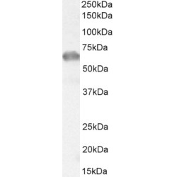 Interleukin-1 Receptor Associated Kinase 3 (IRAK3) Antibody