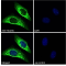 Mucin-5B (MUC5B) Antibody