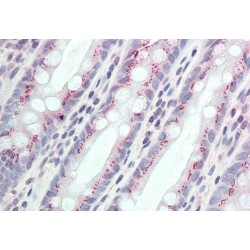 Coiled-Coil Domain Containing 3 (CCDC3) Antibody