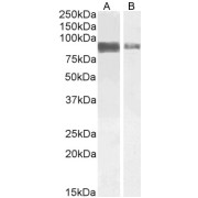 abx432183 (1 µg/ml) staining of Jurkat (A) and (2 µg/ml) A431 (B) cell lysate (35 µg protein in RIPA buffer). Detected by chemiluminescence.