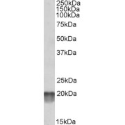 abx432192 (0.1 µg/ml) staining of Human Heart lysate (35 µg protein in RIPA buffer). Primary incubation was 1 hour. Detected by chemiluminescence.