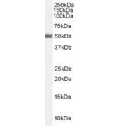 abx432198 (0.3 µg/ml) staining of Human Lung lysate (35 µg protein in RIPA buffer). Primary incubation was 1 hour. Detected by chemiluminescence.