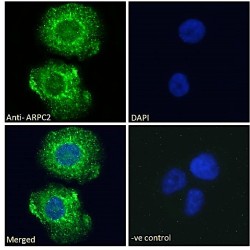Actin Related Protein 2/3 Complex Subunit 2 (ARPC2) Antibody