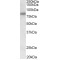 Serologically Defined Colon Cancer Antigen 8 (SDCCAG8) Antibody