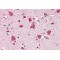 Serologically Defined Colon Cancer Antigen 8 (SDCCAG8) Antibody