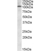 abx432215 (0.2 µg/ml) staining of Human Spleen lysate (35 µg protein in RIPA buffer). Detected by chemiluminescence.