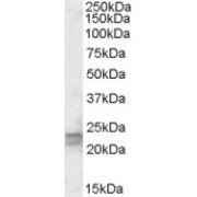 abx432225 (0.5 µg/ml) staining of Human Lung lysate (35 µg protein in RIPA buffer). Primary incubation was 1 hour. Detected by chemiluminescence.