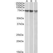 abx432227 (1 µg/ml) staining of HepG2 (A), K562 (B) and HeLa (C) nuclear lysates (35 µg protein in RIPA buffer). Detected by chemiluminescence.