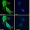 Triggering Receptor Expressed On Myeloid Cells 2 (Trem2) Antibody