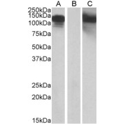 HEK293 lysate (10 µg protein in RIPA buffer) overexpressing Human CDH11 with C-terminal MYC tag probed with abx432236 (1 µg/ml) in Lane A and probed with anti-MYC Tag (1/1000) in lane C. Mock-transfected HEK293 probed with abx432236 (1mg/ml) in Lane B. Primary incubations were for 1 hour. Detected by chemiluminescence.