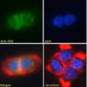 abx432244 Immunofluorescence analysis of paraformaldehyde fixed A431 cells, permeabilized with 0.15% Triton. Primary incubation 1hr (10 µg/ml) followed by AF488 secondary antibody (2 µg/ml), showing nuclear staining. Actin filaments were stained with phalloidin (red) and the nuclear stain is DAPI (blue). Negative control: Unimmunized goat IgG (10 µg/ml) followed by AF488 secondary antibody (2 µg/ml).