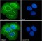 Retinal-Specific ATP-Binding Cassette Transporter (ABCA4) Antibody