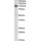 Multidrug Resistance-Associated Protein 4 (ABCC4) Antibody