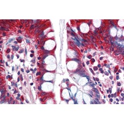 Acyl-CoA Synthetase Long-Chain Family Member 5 (ACSL5) Antibody