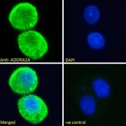 abx432284 Immunofluorescence analysis of paraformaldehyde fixed HepG2 cells, permeabilized with 0.15% Triton. Primary incubation 1hr (10 µg/ml) followed by AF488 secondary antibody (2 µg/ml), showing cytoplasmic staining. The nuclear stain is DAPI (blue). Negative control: Unimmunized goat IgG (10 µg/ml) followed by AF488 secondary antibody (2 µg/ml).