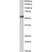 abx432287 (1 µg/ml) staining of Human Prostate lysate (35 µg protein in RIPA buffer). Primary incubation was 1 hour. Detected by chemiluminescence.