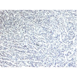 Beta-1 Adrenergic Receptor (ADRB1) Antibody