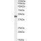 Adrenergic Receptor Beta 3 (ADRB3) Antibody