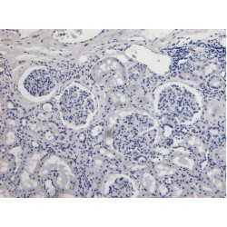 Apoptosis Inducing Factor 1, Mitochondrial (AIFM1) Antibody