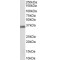 Aldo-Keto Reductase Family 1 Member C3 (AKR1C3) Antibody