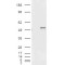 Retinal Dehydrogenase 1 (ALDH1A1) Antibody