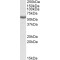 Aldehyde Dehydrogenase 3 Family Member B1 (ALDH3B1) Antibody