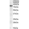 Polyunsaturated Fatty Acid Lipoxygenase ALOX15 (ALOX15) Antibody