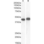 abx432321 (1 µg/ml) staining of CaCo-2 (A) and (0.1 µg/ml) LNCaP (B) cell lysate (35 µg protein in RIPA buffer). Detected by chemiluminescence.