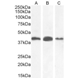 Alpha-Methylacyl-CoA Racemase (AMACR) Antibody