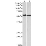 abx432329 (0.01 µg/ml) staining of HeLa (A) and Jurkat (B) lysates (35 µg protein in RIPA buffer). Primary incubation was 1 hour. Detected by chemiluminescence.