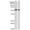 Annexin A11 (ANXA11) Antibody