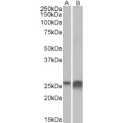 abx432346 (0.3 µg/ml) staining of Human Kidney (A) and Liver (B) lysates (35 µg protein in RIPA buffer). Detected by chemiluminescence.