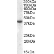 abx432356 (2 µg/ml) staining of Human Skeletal Muscle lysate (35 µg protein in RIPA buffer). Primary incubation was 1 hour. Detected by chemiluminescence.