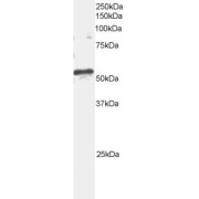 abx432362 staining (2 µg/ml) of mouse brain extracts (RIPA buffer, 35 µg total protein per lane). Primary incubated for 1 hour. Detected by western blot using chemiluminescence.