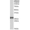 Rho GDP-Dissociation Inhibitor 2 (ARHGDIB) Antibody