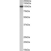 abx432367 (1 µg/ml) staining of HeLa nuclear lysate (35 µg protein in RIPA buffer). Primary incubation was 1 hour. Detected by chemiluminescence.