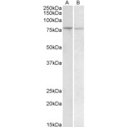 abx432389 (1 µg/ml) staining of Human Peripheral Blood Lymphocytes (A) and Human Spleen (B) lysate (35 µg protein in RIPA buffer). Primary incubation was 1 hour. Detected by chemiluminescence.