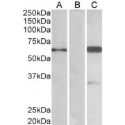 HEK293 lysate (10 µg protein in RIPA buffer) over expressing Human BAIAP2 with DYKDDDDK tag probed with abx432395 (1.0 µg/ml) in Lane A and probed with anti- DYKDDDDK Tag (1/3000) in lane C. Mock-transfected HEK293 probed with abx432395 (1mg/ml) in Lane B. Primary incubations were for 1 hour. Detected by chemiluminescence.