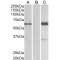 BAIAP2 (Isoform 3) Antibody