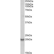 abx432399 (0.2 µg/ml) staining of Human Bone Marrow lysate (35 µg protein in RIPA buffer). Primary incubation was 1 hour. Detected by chemiluminescence.