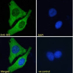 BH3-Interacting Domain Death Agonist (BID) Antibody