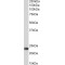 Biliverdin Reductase B (BLVRB) Antibody