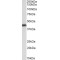 Polycomb Complex Protein BMI-1 (BMI1) Antibody