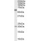 Bone Morphogenetic Protein Receptor 1A (BMPR1A) Antibody