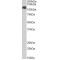 Bone Morphogenetic Protein Receptor 2 (BMPR2) Antibody