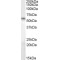 Bruno-Like Protein 5 (BRUNOL5) Antibody