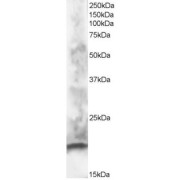 abx432435 staining (1 µg/ml) of human brain lysate (RIPA buffer, 30 µg total protein per lane). Primary incubated for 1 hour. Detected by western blot using chemiluminescence.